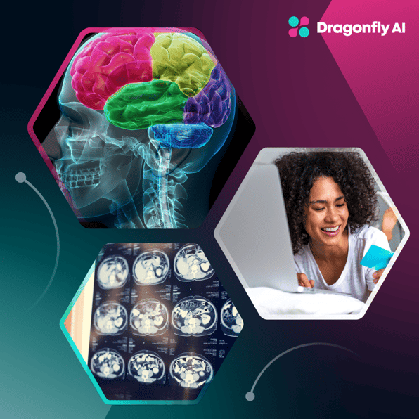 neuromarketing visual with brain scan images